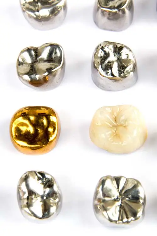dentalgold-ankauf