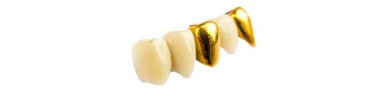Zähne und Goldzähne